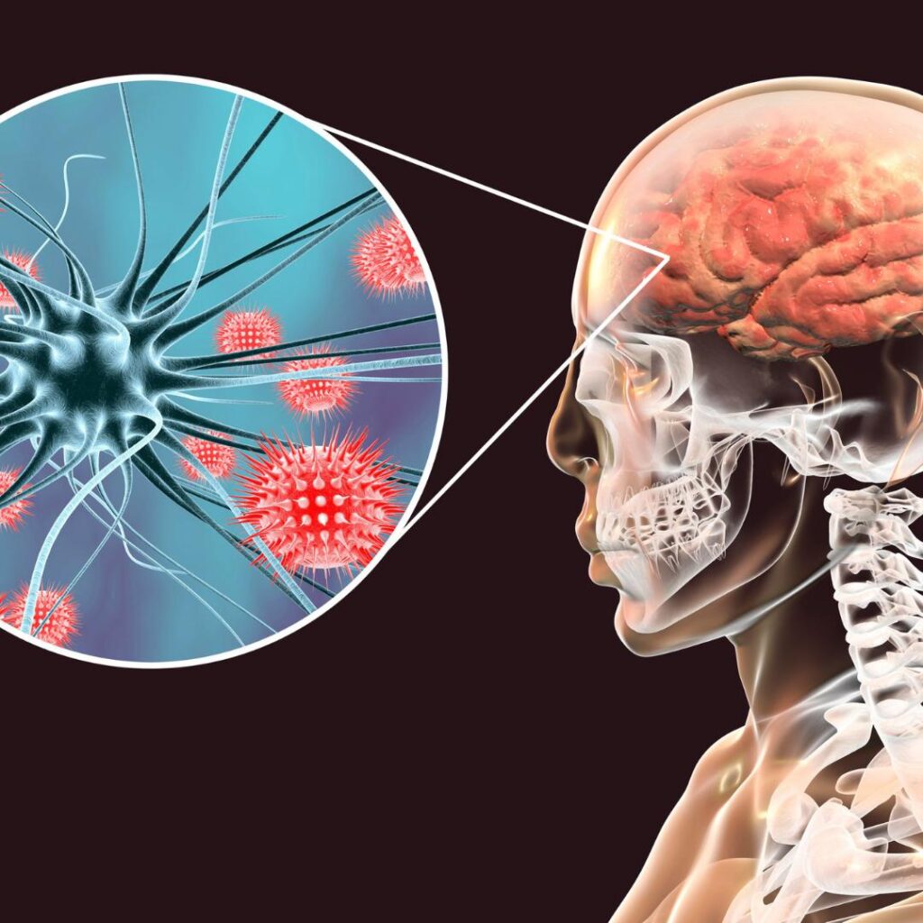 Dia Mundial Da Meningite Confira As Principais D Vidas Sobre A Meningite Meningoc Cica O