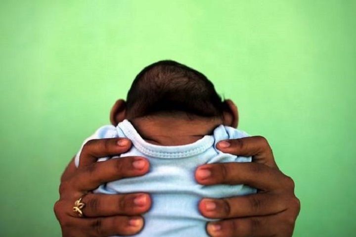 Pesquisa mostra correlação entre desnutrição materna e microcefalia
