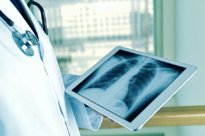 Radioterapia é indicada para alívio da dor de metástases ósseas