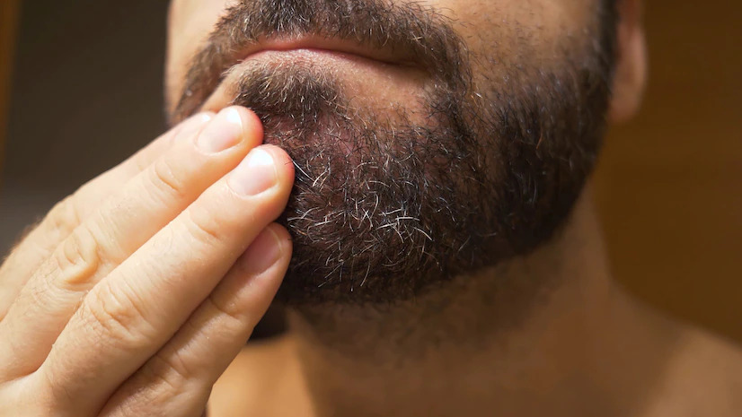 O que fazer para acabar com a coceira na barba?