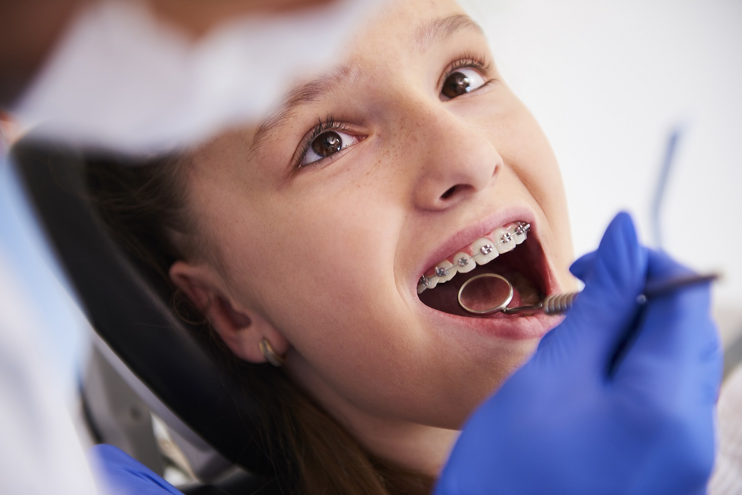 Julho Laranja promove a Ortodontia preventiva e os cuidados com a saúde bucal