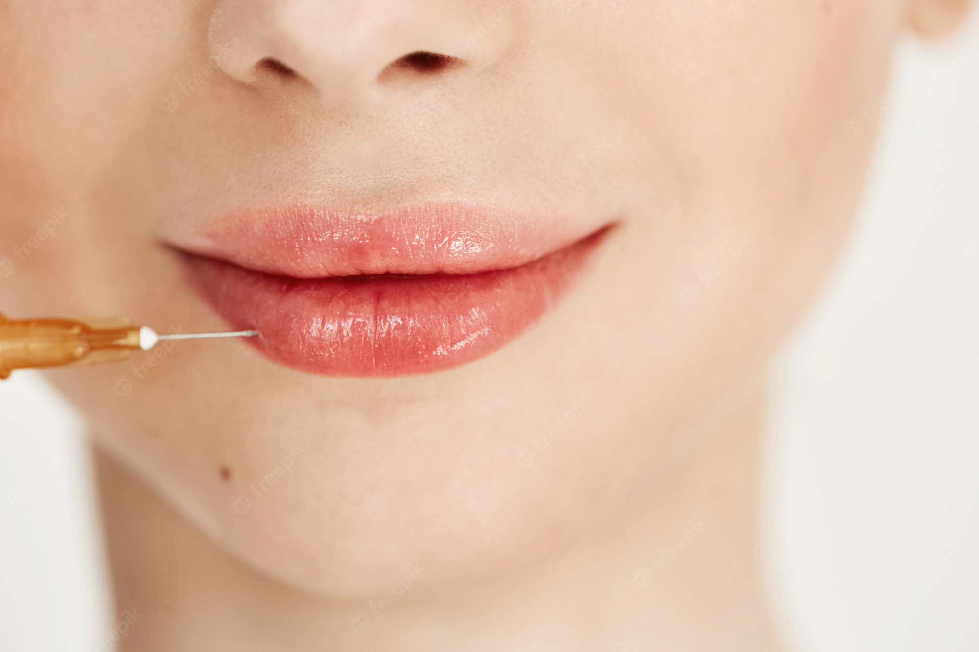 Preenchimento labial: escolha pelo tratamento requer atenção