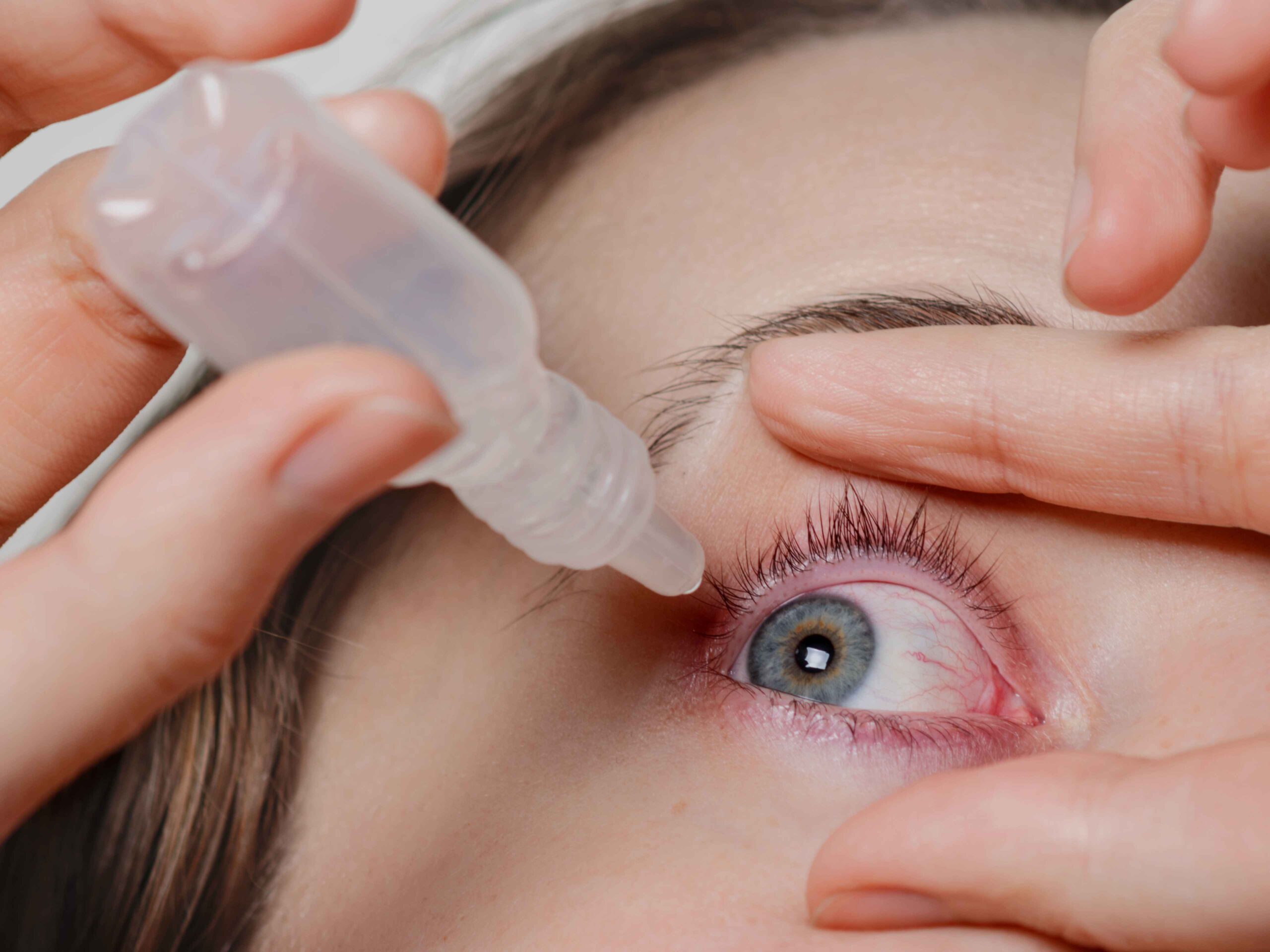 Aumenta  o número de casos de síndrome de olho seco no DF