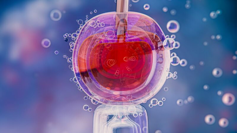 Pacientes recorrem ao uso do FGTS para custear FIV