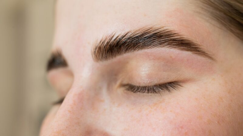 FUE Long Hair dá naturalidade ao transplante de sobrancelhas