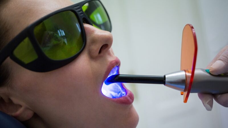 Técnicas com laser avançam em tratamentos odontológicos