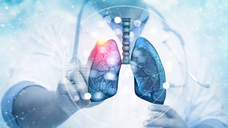 Aumento das doenças respiratórias preocupam médicos