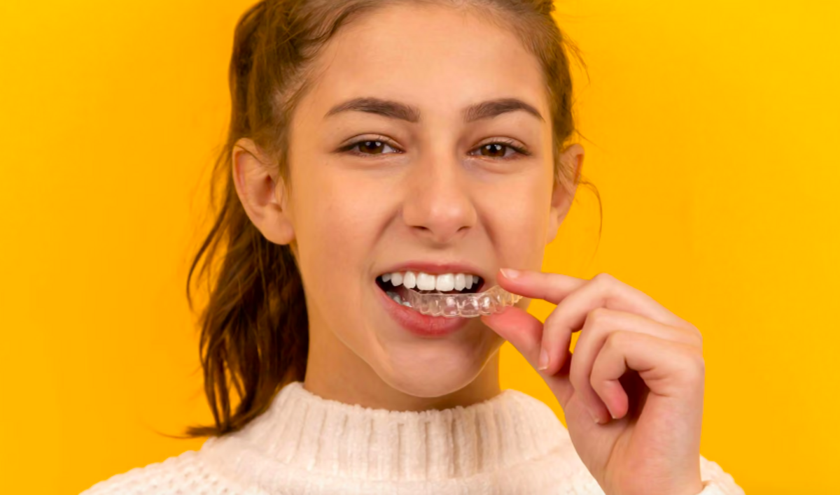 Alinhador invisível: como funciona o tratamento dentário