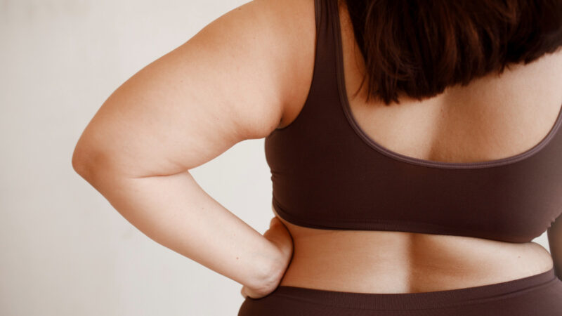 Canetas emagrecedoras não substituem cirurgia bariátrica