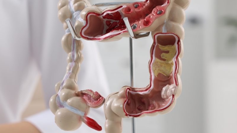 Adrian Bester lança curso on-line de modulação intestinal