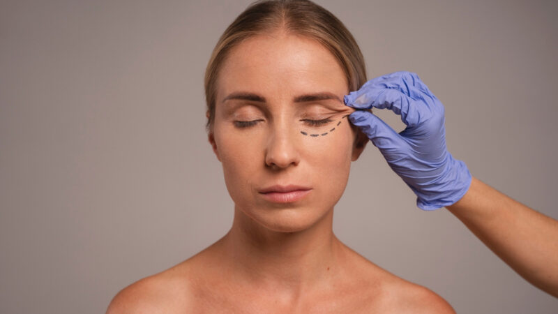 Estética do olhar adota abordagens para resultados naturais