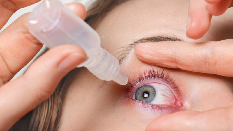 Tratamento da rosácea ocular avança com uso de tecnologia