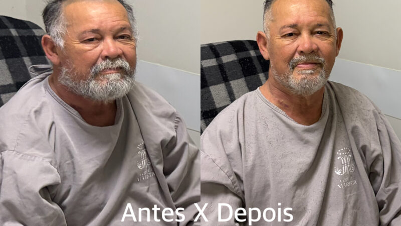 Enfermeiro transforma corte de cabelo em resgate à autoestima de pacientes em hospital 100% SUS