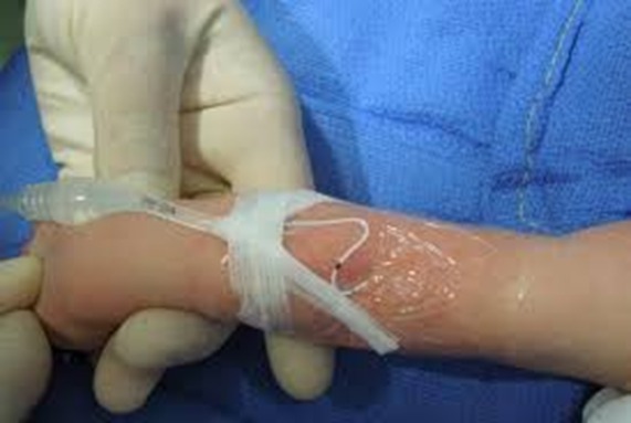 Paraná registra 2.060 incidentes associados aos cuidados em saúde em recém-nascidos em oito anos