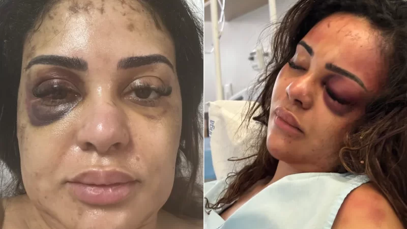 Agressão contra Médica em Maringá: Advogado César Castellucci conversa com Cristina Calixto sobre o caso