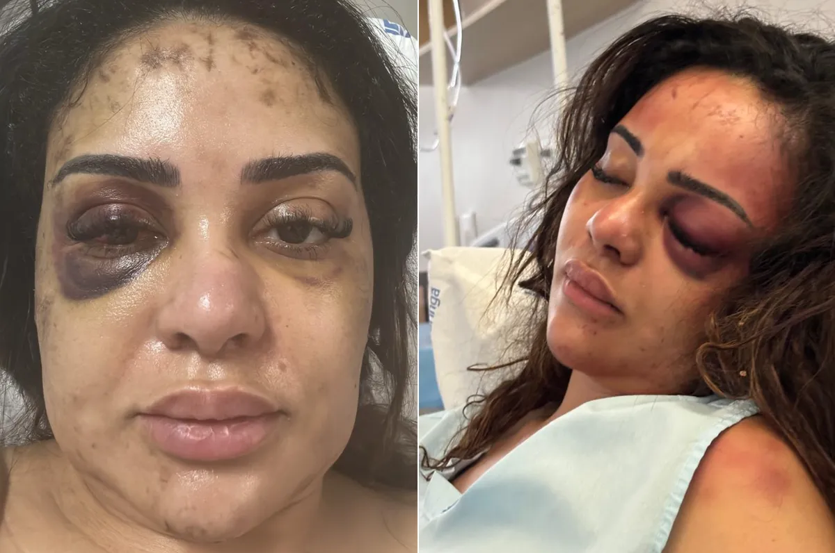 Agressão contra Médica em Maringá: Advogado César Castellucci conversa com Cristina Calixto sobre o caso
