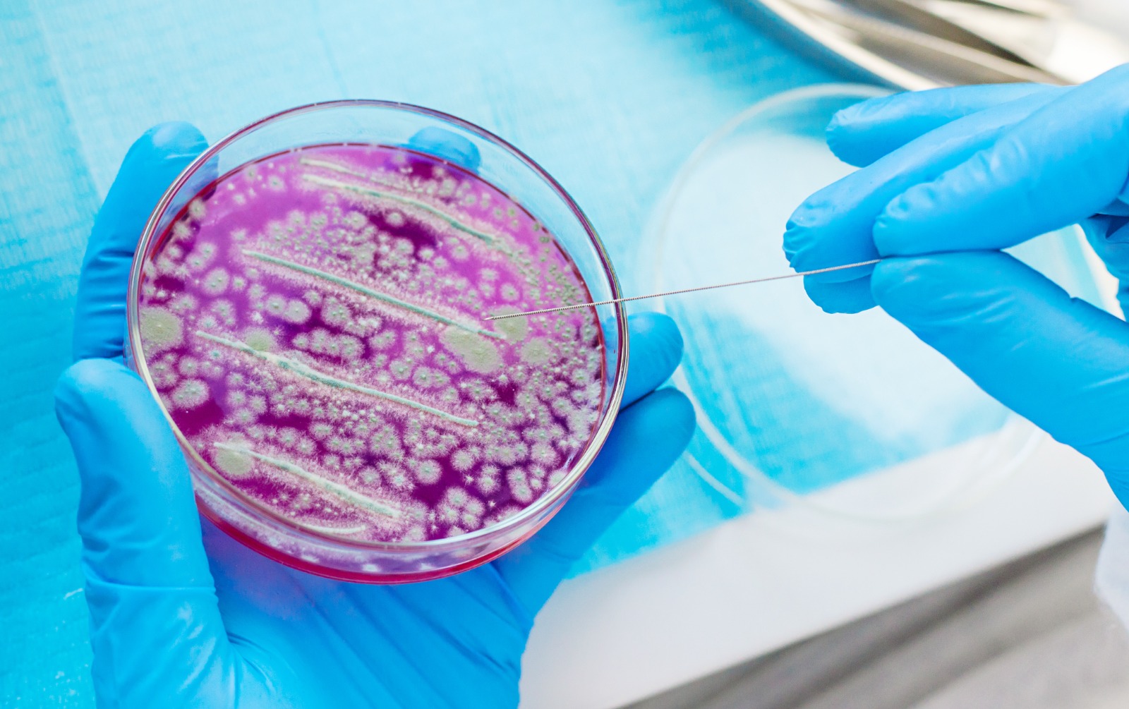 Resistência a antibióticos pode matar mais que câncer até 2050, alertam pesquisadores