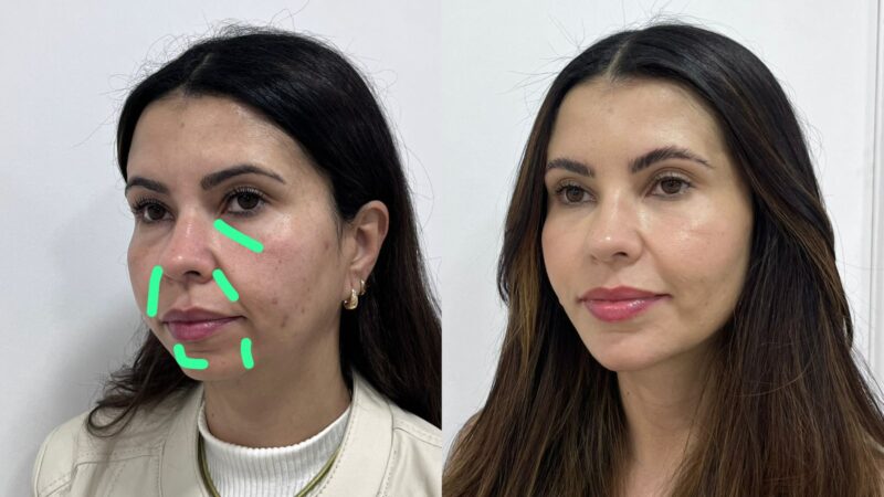 As sombras do rosto denunciam a idade
