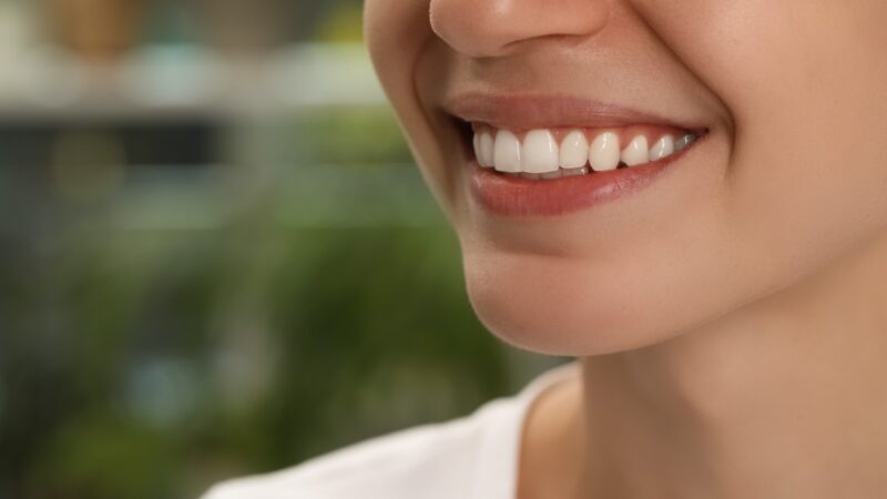 14 milhões de brasileiros vivem sem nenhum dente; perda dentária vai além da estética