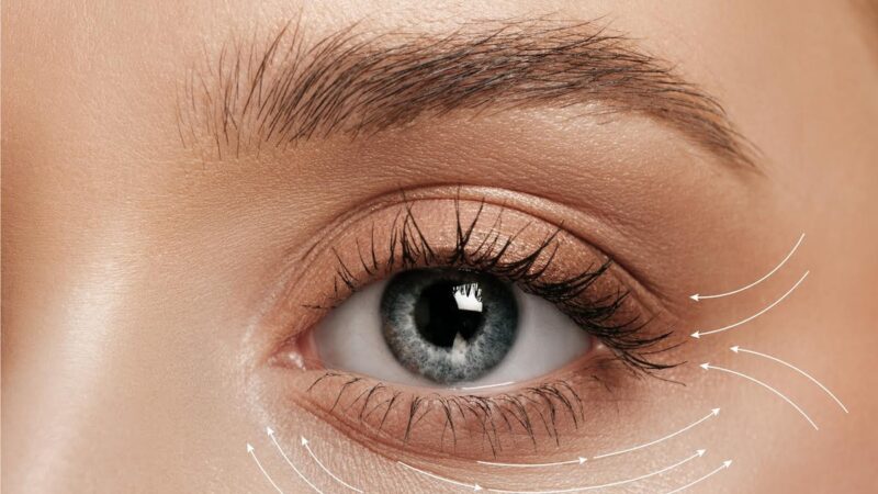 Blefaroplastia lidera ranking mundial de cirurgias