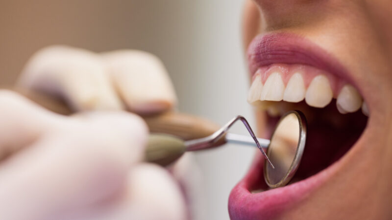 Sangramento na gengiva pede avaliação, alerta dentista