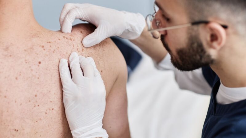 Desinformação e estigmas sobre a hanseníase atrasam cuidados