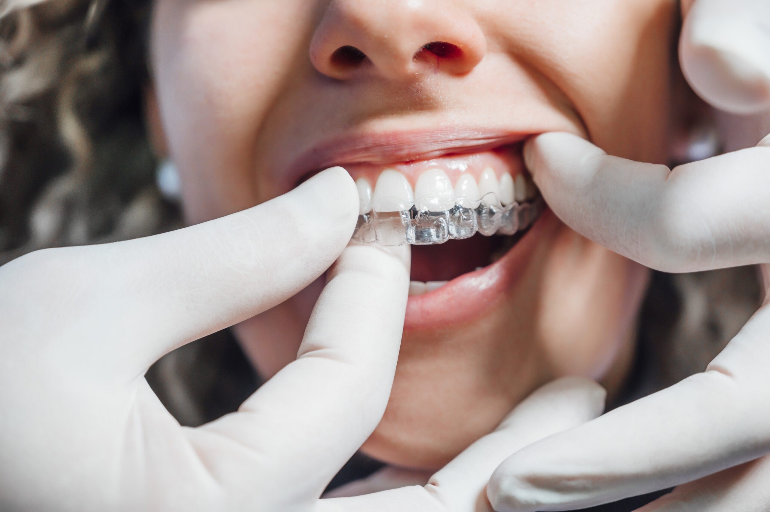 Universidade prorroga inscrições para tratamento dentário gratuito