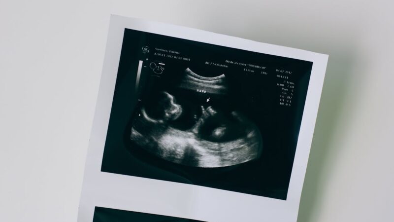 Cirurgia fetal minimamente invasiva tem resultado promissor
