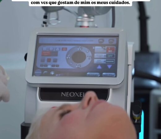 Laser de CO2 Neoxel ganha destaque com Xuxa