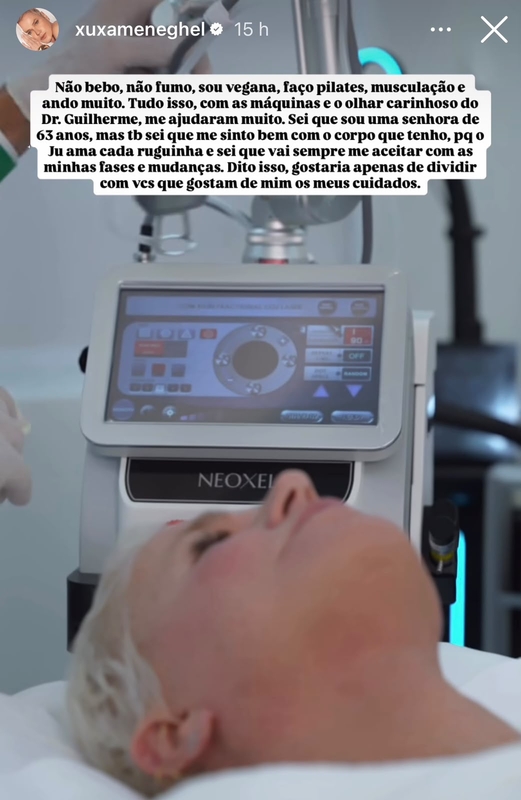 Laser de CO2 Neoxel ganha destaque com Xuxa